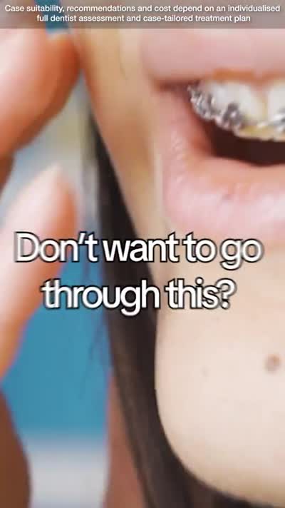video ad